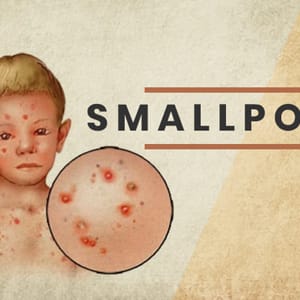 Smallpox disease